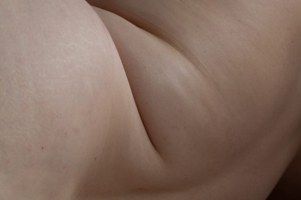 Image of folds of skin